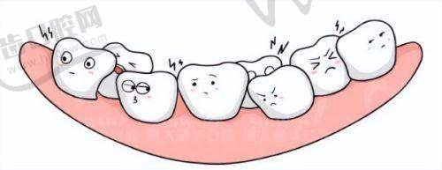 汕头奥诗卡口腔元旦种植2680种一送一寒假矫正4500起，黄丞蔚沈承骏坐诊技术好服务细