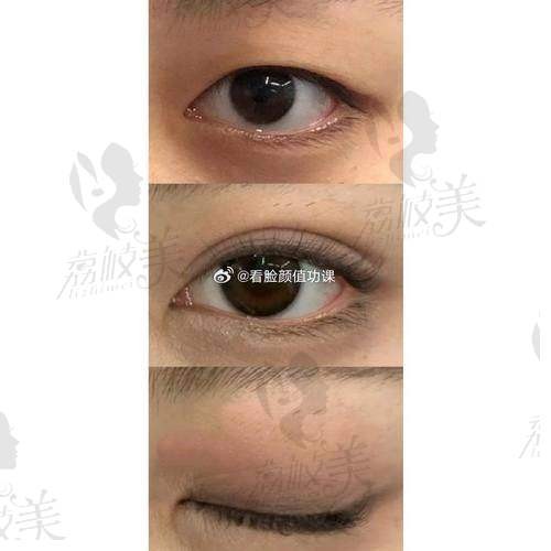 搭配附加项目优惠多、成效更佳