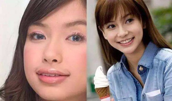 杨颖矫正牙齿的具体时间是什么时候？有确切消息吗？-图1