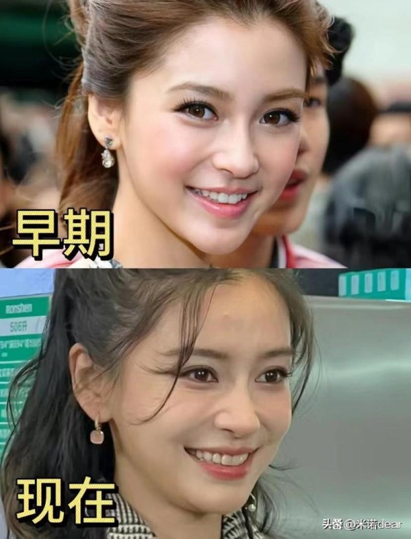 杨颖矫正牙齿的具体时间是什么时候？有确切消息吗？-图2