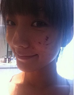 惨遭破相有惊人谜团的十大明星（图）