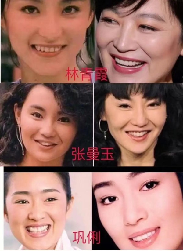 为何成年明星纷纷选择矫正牙齿?年龄是影响因素吗?-图2