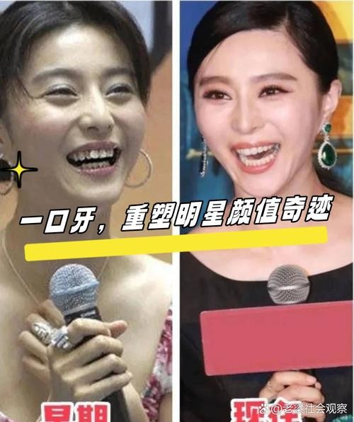 明星晒矫正牙齿照,有何深层用意?