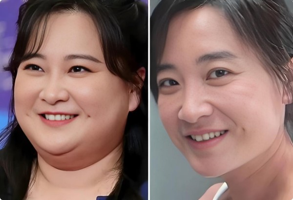 贾玲米兰近照引热议!减重百斤后脸颊松弛显沧桑,酒窝不见成焦点