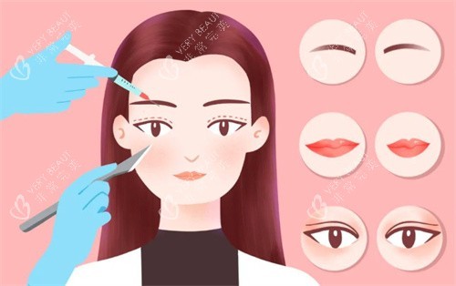 双眼皮修复卡通