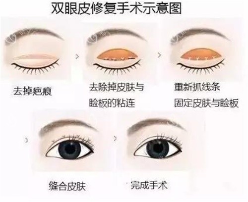 宋立男PK王香平:谁才是眼修复界的隐形冠军?看完这篇不再选择困难