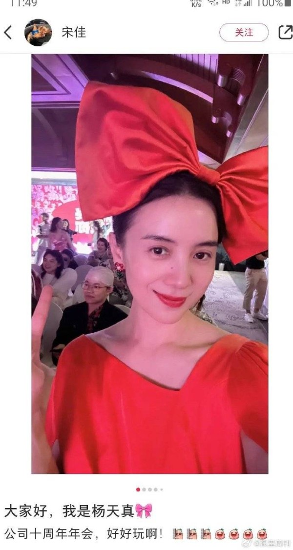 宋佳与壹心娱乐：演艺之路的别样精彩