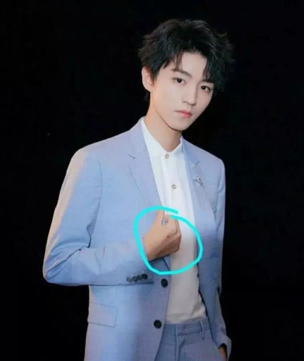 王俊凯近照曝光,脸上爆痘,身上多处擦伤,网友得知原因:心疼!