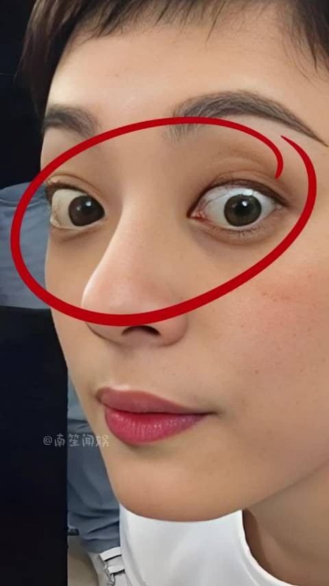 为何孙俪突然眼睛凸起?本以为是得了甲亢,真相曝光竟被骗了多年 李连杰