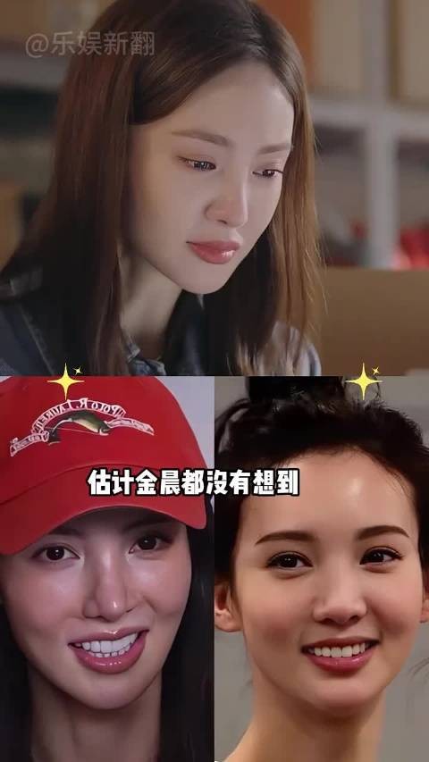 金晨因鼻子变形被嘲整容的委屈,竟在一场车祸后迎来口碑逆袭