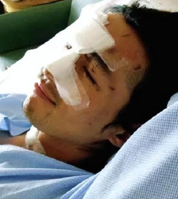 从烧伤低谷到事业新生，俞灏明的“重生”之路？