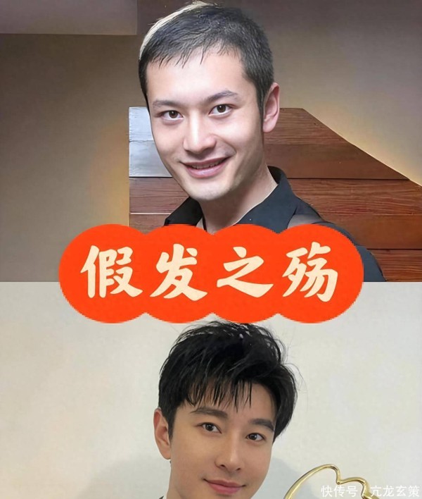 这才是真实状态下的黄晓明，不戴假发的他头发稀疏脱发严重！