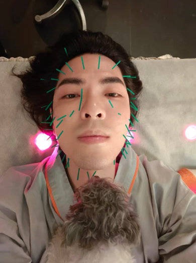 萧敬腾陪老婆林有慧针灸 脸上扎针数量超五十支