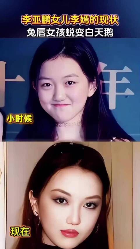 李亚鹏干的是功德无量的事,值得尊重