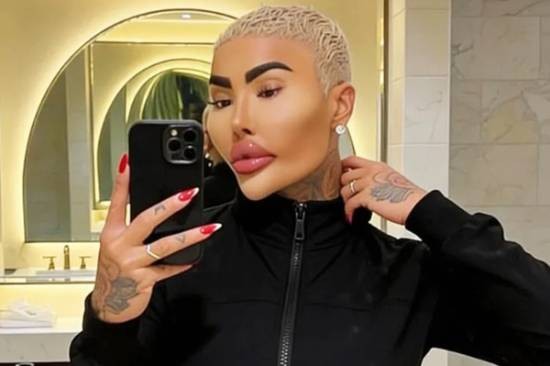 整形明星“唇王”乔丹·詹姆斯·帕克疑因整形离世 两人涉嫌过失杀人被捕