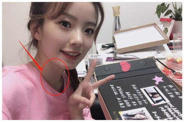陈卓璇无美颜无滤镜下原来长这样，有谁注意她的脖子？原来是胎记