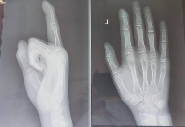 不排队,超会聊!365天守护你,AI健康顾问潮小康上线