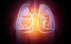医生提醒：无论多坏的肺，只要常吃这5样，肺一天比一天好