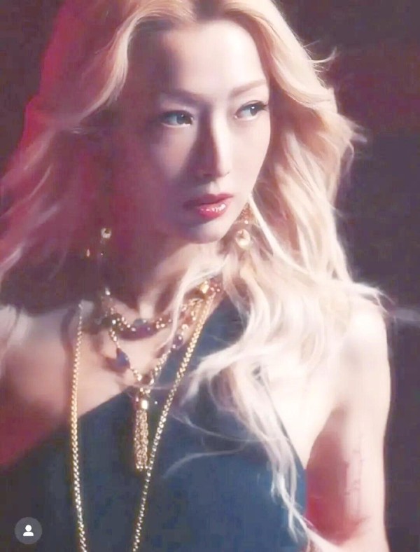 郑秀文运动受伤恢复:从轮椅到舞台的坚韧之路