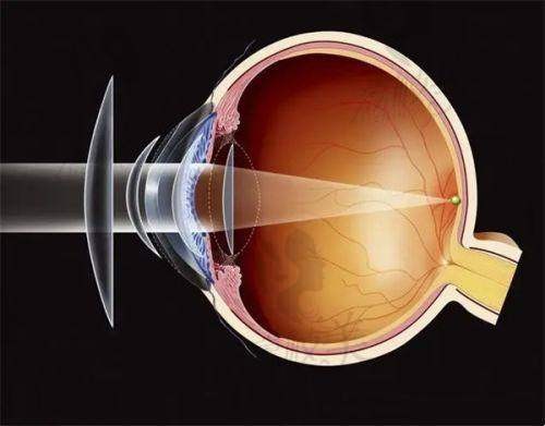 南京维视眼科口碑如何?全链路诊疗覆盖全年龄段眼部需求