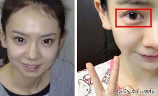 “割双眼皮”最成功的四位明星，戚薇罗志祥上榜，成龙大哥逆袭