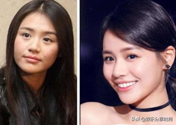 “割双眼皮”最成功的四位明星，戚薇罗志祥上榜，成龙大哥逆袭