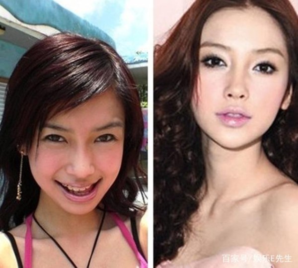 明星整形也有套路，揭秘你不知道的娱乐圈整形趋势