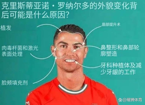 为了帅过贝克汉姆，C罗的脸花了几百万？结果连4万美容费都要赖账