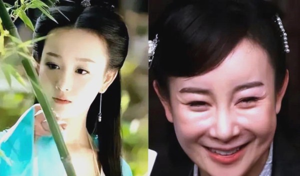 整容之路：明星颜值与演技的艰难平衡