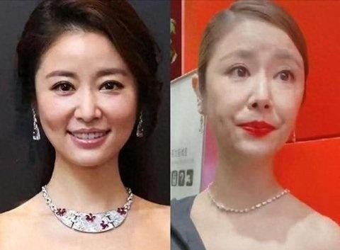 赵丽颖谭松韵郭晶晶生图曝光，差距太大，网友直呼滤镜真能骗人