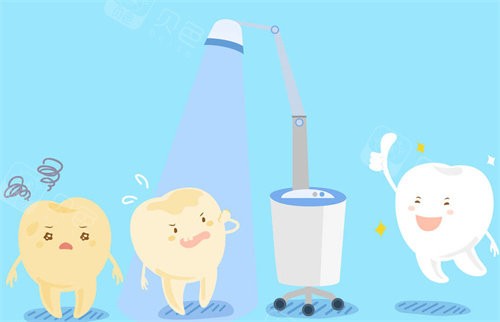 牙齿美白治疗卡通图展示