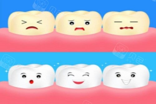 牙齿美白卡通展示