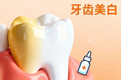 牙齿美白卡通图片展示