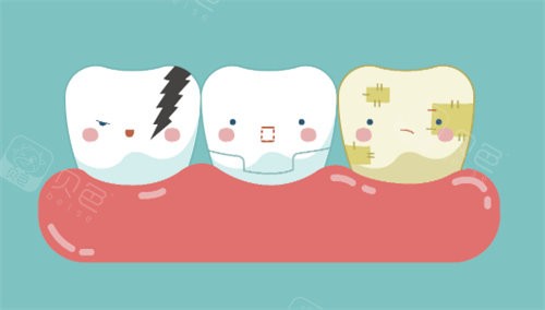 牙齿美白对比卡通图