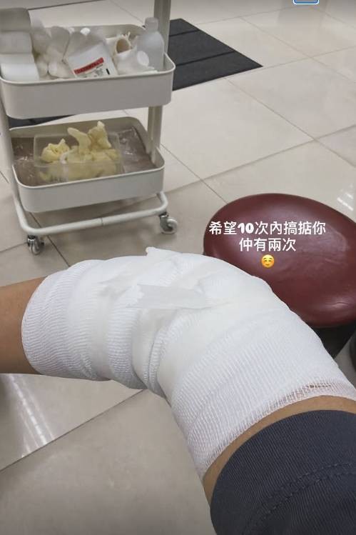 44岁前TVB女星惊爆长期病患，厚重包扎触目惊心令网友心疼，情路坎坷事业陷僵局