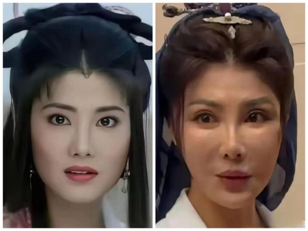 张靓颖自曝医美翻车，为何她的坦诚比明星们的否认更圈粉？