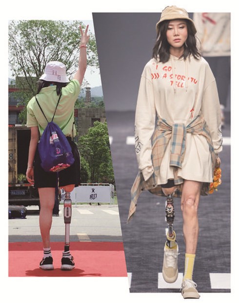最美马拉松女孩穿假肢走秀：不完美依然可以闪闪发光