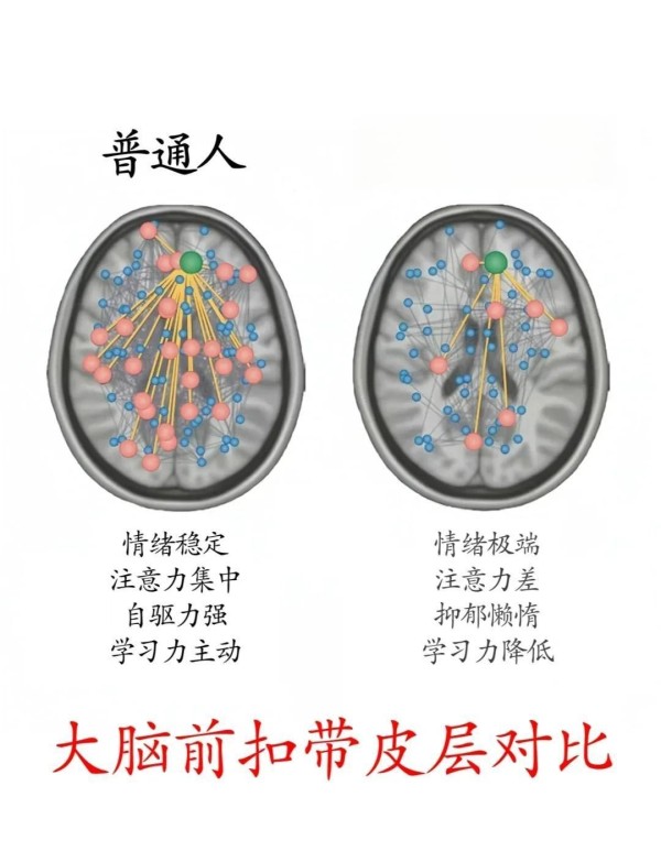 张国荣陨落真相：娱乐圈高压如何吞噬完美主义者？