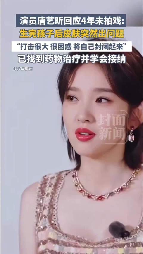 唐艺昕身体出问题被张若昀治愈 自曝因皮肤原因4年未拍戏