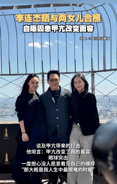 李连杰回应因患甲亢改变面容：那大概是我人生中最艰难的时期