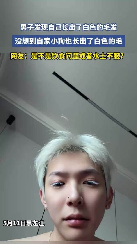 男子发现自己长出了白色的毛发，没想到自家小狗也长出了白色的毛