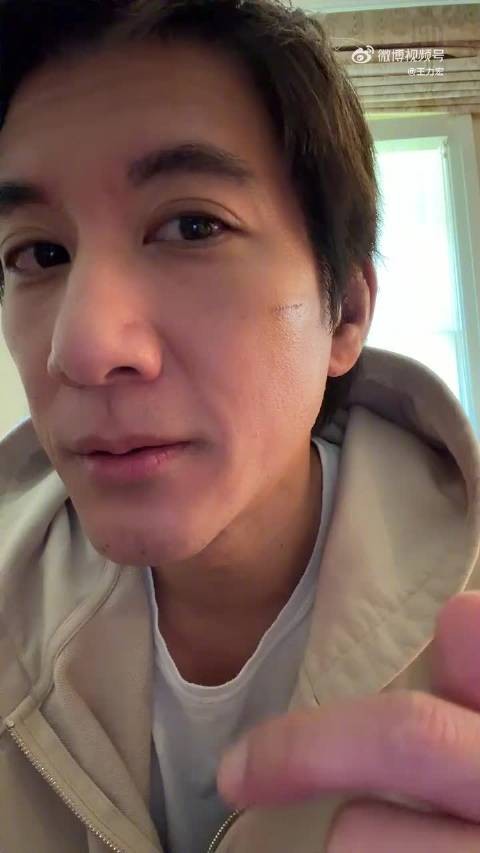 王力宏回应恢复近况:明日拆线