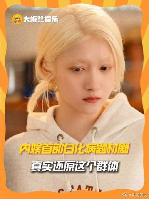 内娱终于出现了以白化病为题材的剧