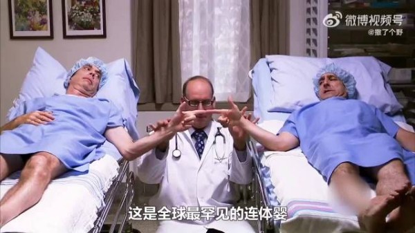 罕见的连体婴做完手术就傻眼了,这医生也太奇葩了