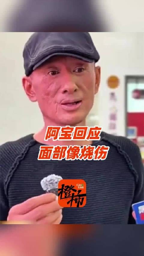 阿宝嘴周疤痕是车祸意外